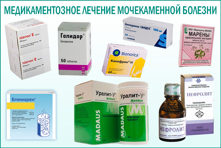 Лекарства при мочекаменной болезни