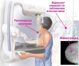 Маммографическое обследование молочных желез - как это делается