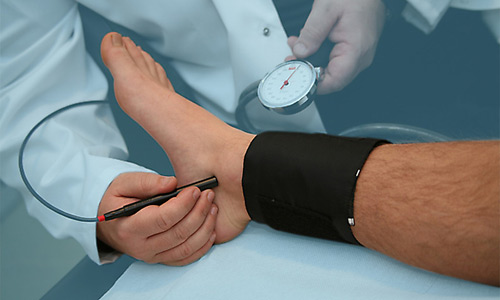 измерение давления на ноге 