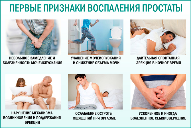 Prostata massage gefährlich