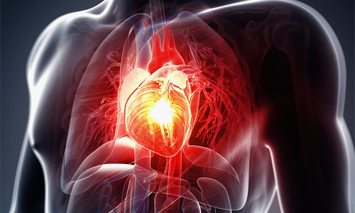 акроцианоз - симптом больного сердца