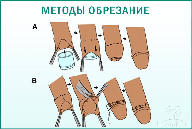 Методы обрезания