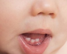 Сколько у детей должно быть молочных зубов, сроки прорезывания и выпадения