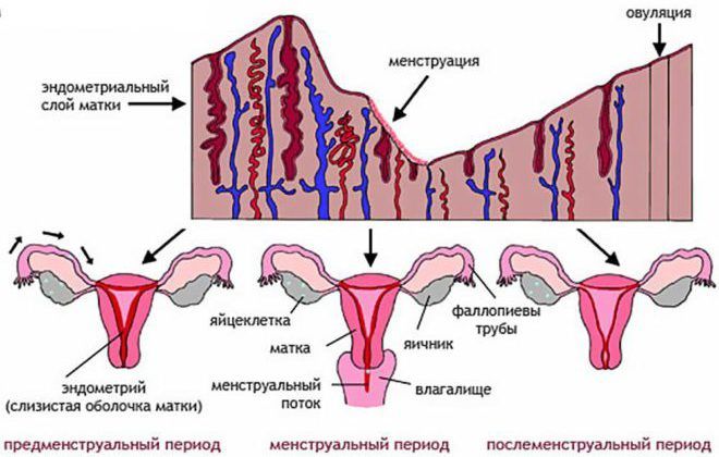 Обильные болезненные менструации
