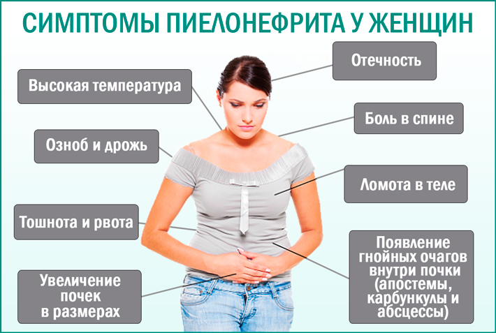 Пиелонефрит: симптомы у женщин