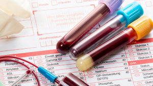 Что бы выявить в организме гормональные нарушения, нужно сдать анализ крови