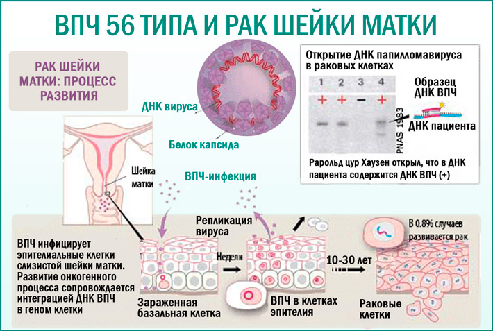 ВПЧ 56 типа у женщин и мужчин: что это, особенности лечения etamedicina.ru.