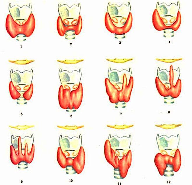 Нормальные формы щитовидной железы