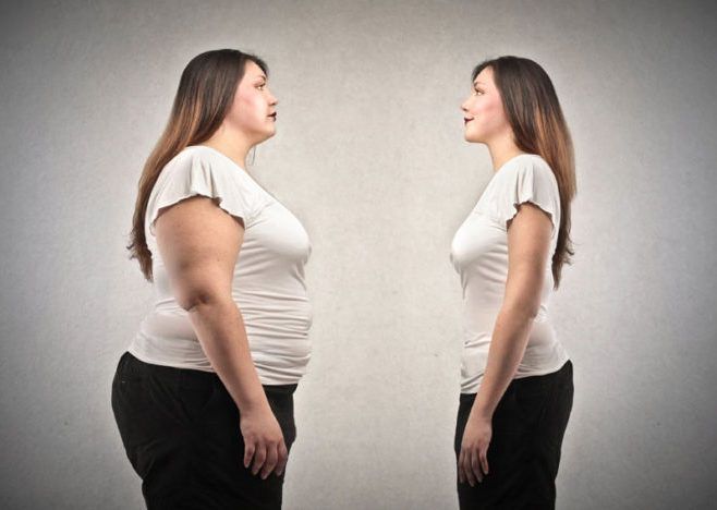 Похудение после ожирения